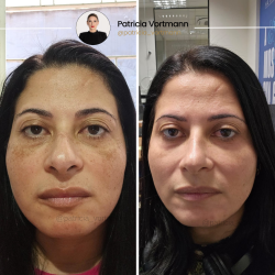 resultados (5)