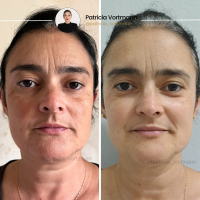resultados (6) (1)